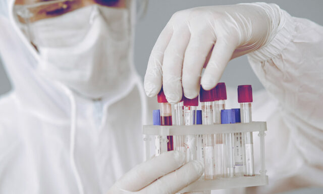 Covid-19 Tests Available